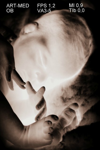 Спящая малышка Рози 2. Куколка реборн Виктории Вишни (фото 2)