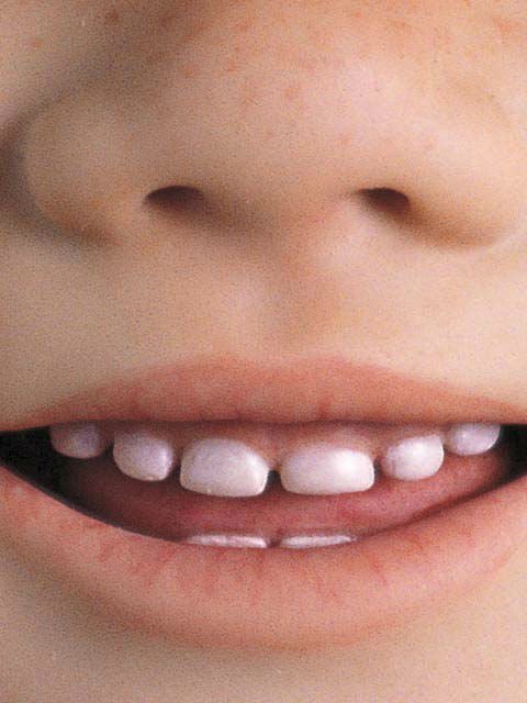 Liska and Lotta великолепная парочка от Annette Himstedt спецвыпуск коллекции 2005 года Summer Kinder (фото 5)